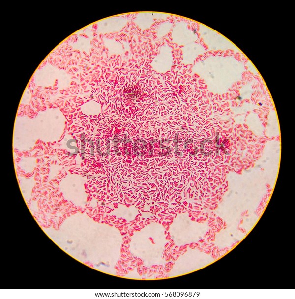 Escherichia Coli Gram Staining Compound Microscope Stock Photo Edit Now