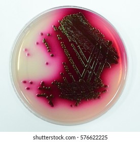 Escherichia Coli On Endo Agar Plate (upright View). Green Metallic Sheen Of The Culture And Purple Medium Around It Distinguishing Lactose-fermenting Bacteria (e.g. E. Coli) Are Visible.