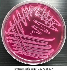 329 Escherichia coli on macconkey agar Images, Stock Photos & Vectors ...