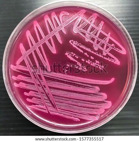 Escherichia coli on Macconkey agar