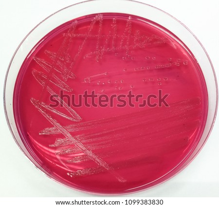 Escherichia Mac Conkey Agar Stock Photo (Edit Now) 1099383830 ...