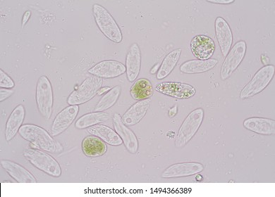 Euglena On Microscope Images Stock Photos Vectors Shutterstock