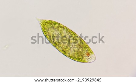 Euglena species. Probably Euglena magnifica. 400x magnification. Photo with selective focus