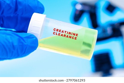 Evaluates kidney function by measuring creatinine levels in urine and blood. urine lab test