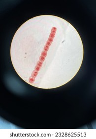 Every phase Mitosis cell in the Root tip of Onion under a microscope in one line.