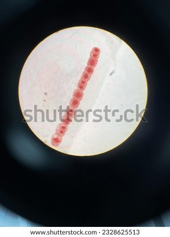 Every phase Mitosis cell in the Root tip of Onion under a microscope in one line.