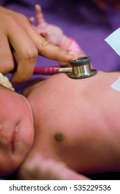 Examination Of Newborn Heart With Pediatric Stethoscope, Showing Normal Chest And Nipple Without Retraction Or Difficulty Of Breathing