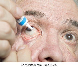 Examination And Treatment Of Patients With Cataract And Glaucoma Eyes