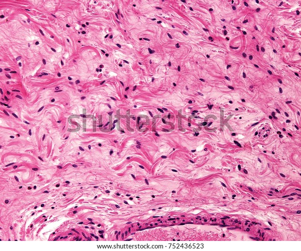 Example Typical Loose Connective Tissue Belonging Stock Photo (Edit Now ...