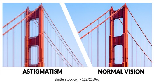 Example of vision with Astigmatism. It is a type of refractive error in which the eye does not focus light evenly on the retina. This results in distorted or blurred vision at all distances