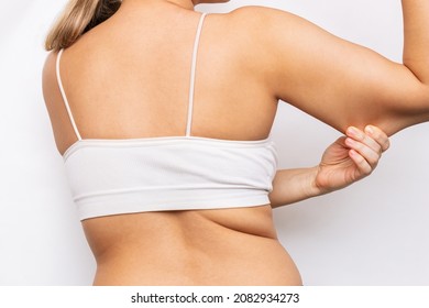 Excess weight on the upper body. Cropped shot of a young woman grabbing skin on her upper arm with excess fat isolated on a white background. The loose and saggy muscles of a back and arms. Overweight