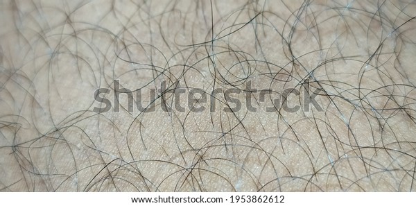 excessive curly black hairs growth on top layer of\
clean white human body skin surface. macro horizontal closeup top\
view.