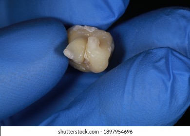 233 Curved tooth roots Images, Stock Photos & Vectors | Shutterstock