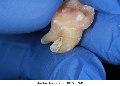 Curved Tooth Roots Images Stock Photos Vectors Shutterstock