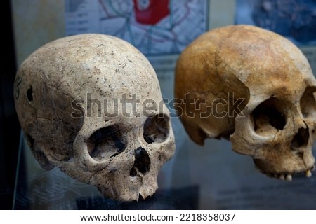 An exhibit of a human skull. Real human skull.