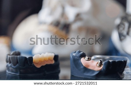 Exhibition examples of dental prostheses, titanium crowns and platforms for pins.