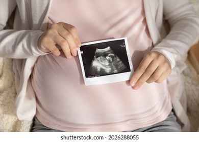 Expectant Mother Holding Ultrasound Scan At Big Tummy, Showing Picture At Camera. Cropped Shot Of Pregnant Woman With Sonogram Image Of Unborn Baby. Prenatal Care, Pregnancy, Motherhood Concept