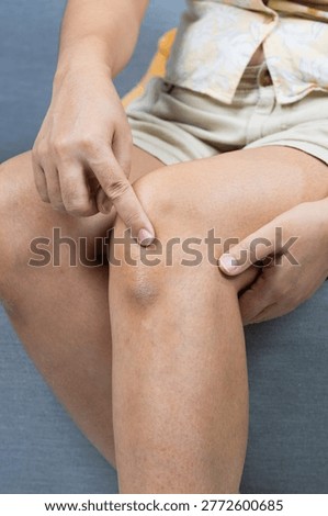 Explore effective methods to alleviate knee pain with proven techniques from comfort of home.