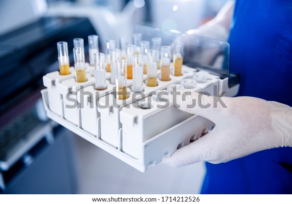 Express analysis of human urine in\
medical laboratory. Lab technician holds test tube\
setup.