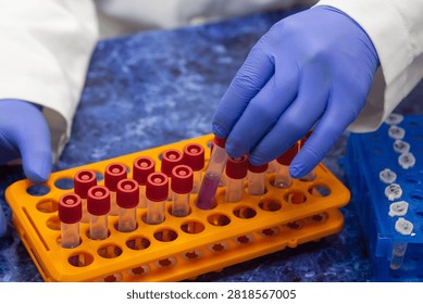 Express analysis test tubes with samples in an orange rack, a scientist takes one test tube out of the rack.