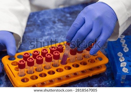 Express analysis test tubes with samples in an orange rack, a scientist takes one test tube out of the rack.