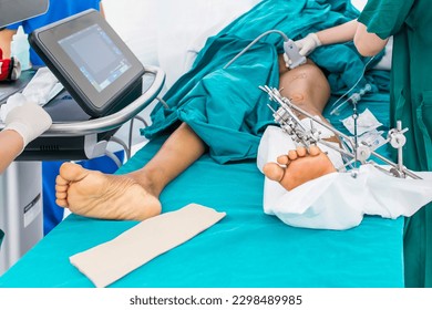 External fixator device in trauma or fracture patient in orthopedic unit.Anesthetist did regional femoral nerve block under ultrasound guidance.Pain free surgery in anesthesia unit with computer. - Shutterstock ID 2298489985