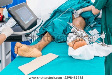 External fixator device in trauma or fracture patient in orthopedic unit.Anesthetist did regional femoral nerve block under ultrasound guidance.Pain free surgery in anesthesia unit with computer.