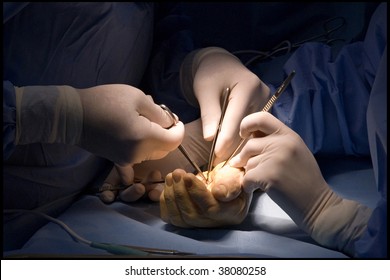 extra closeup of hand surgery
