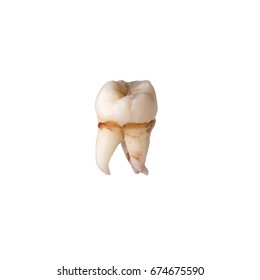 Extracted Wisdom Tooth Stained With Blood Ion The White Background