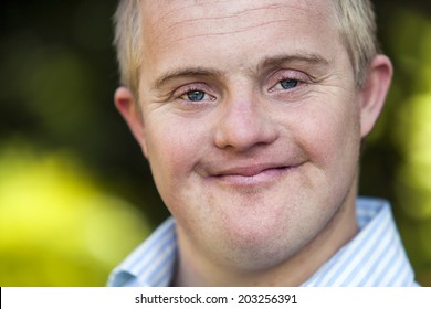 Extreme Close Up Face Shot Of Handicapped Boy Outdoors.