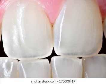 Extreme Close Up Of The Front Incisor Teeth Of An Adult Human Female.  