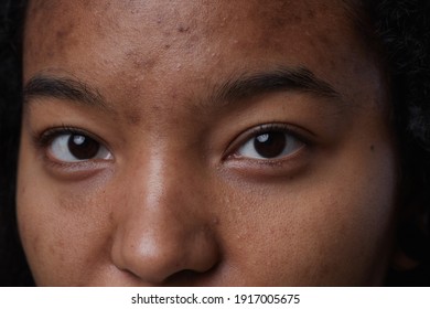 Extreme Close Up Portrait Of Real African American Woman Looking At Camera With Focus On Skin Imperfections