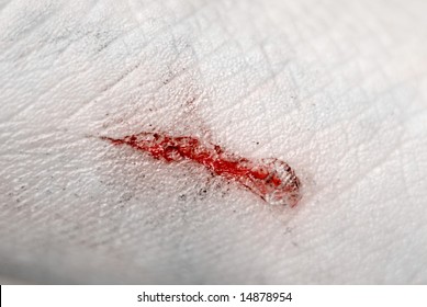 Extreme closeup of bloody, dirty scratch on skin