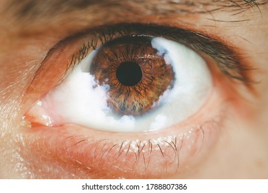 Extreme Closeup Of Human Eye With Clouds - Cloudy Vision Concept