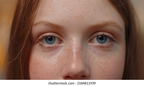 Extreme Close-up Macro Portrait Of Freckles Smiling Girl Face. Teen Beautiful Kid's Eyes, Looking At Camera. Blue Eyes Of Redhead Female Child Model. Young Positive Cute Children Opening Wide Her Eyes