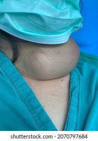 Extremely Large Neck Lump And The Diagnosis Is Multi Nodular Thyroid Goiter In A Young Asian Girl Presenting With Difficulty Breathing