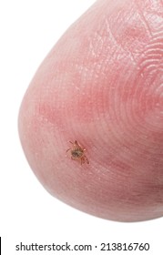 Extremely Tiny Nymph Or Larva Stage Of The Black Legged Eastern Tick Showing Its Underside