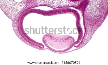 Eye development. Cells from both the mesodermal and the ectodermal tissues contribute to the formation of the eye. In the center is a crystalline lens.