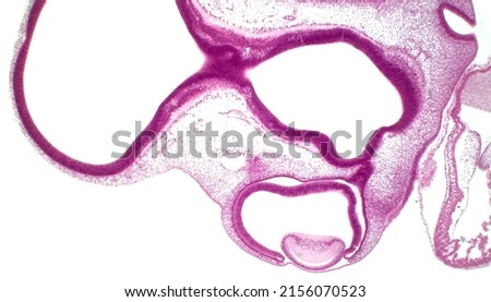 Eye development. Cells from both the mesodermal and the ectodermal tissues contribute to the formation of the eye. In the center is a crystalline lens.
