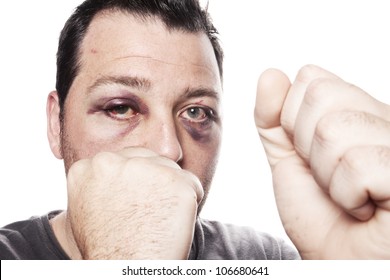 2,241 Male bruised face Images, Stock Photos & Vectors | Shutterstock