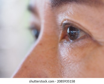 Eye Vision In Elderly Stage: The Closeup Side View Of A Human Eyeball