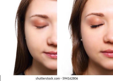 Eyelash Extension. Comparison of female eyes before and after.