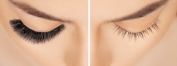 Eyelash Extension Procedure Before After. False Eyelashes. Close Up Portrait Of Woman Eyes With Long Lashes In Beauty Salon. Eyelash Removal Procedure Close Up.