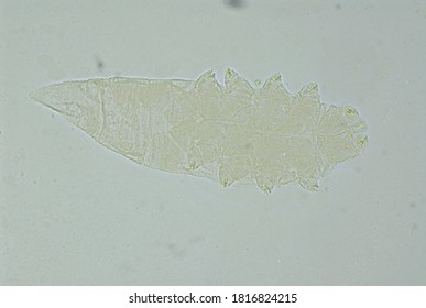 Eyelash Mite Demodex Sp. Under The Microscope