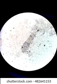 Eyelash Mites (demodex)