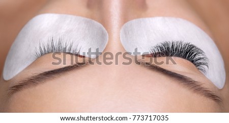 Eyelash removal procedure close up. Beautiful Woman with long lashes in a beauty salon. Eyelash extension.