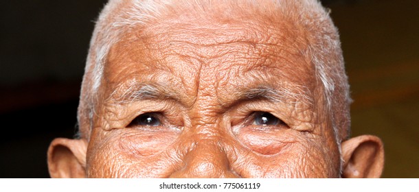 Eyes Of Old Woman, Minor Cataract Patient