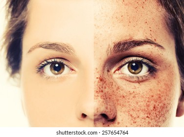  Eyes Woman Freckle Happy Young Beautiful Studio Portrait With Healthy Skin Half