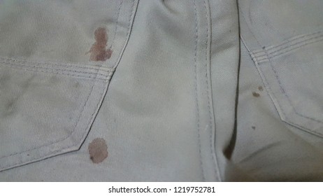 The Fabric Of Blood Stained Pants.