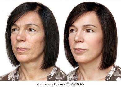 Face 50yearold Woman Before After Cosmetic Stock Photo 2034610097 ...